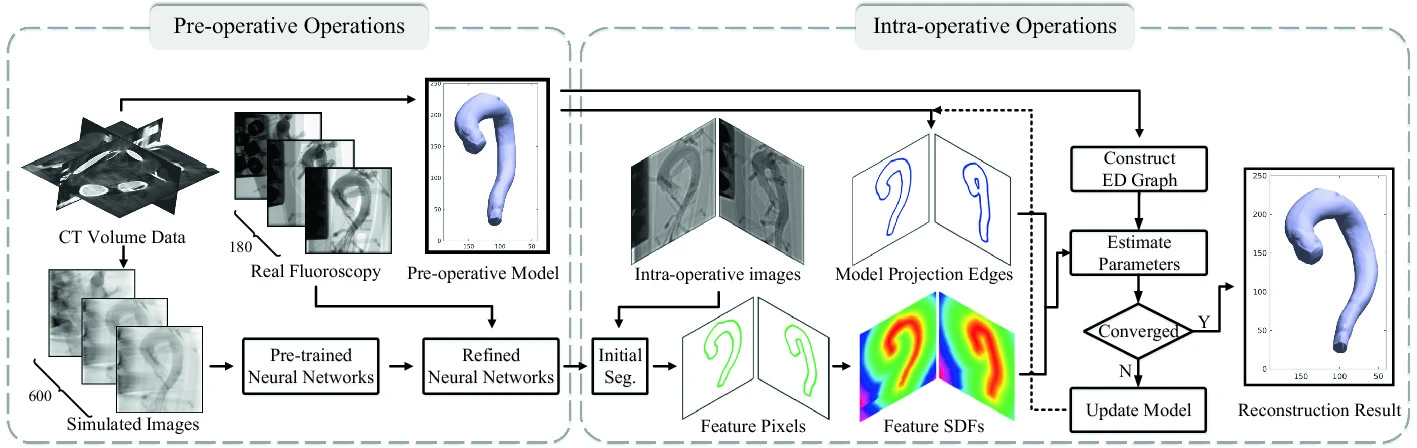 3D Aortic Reconstruction